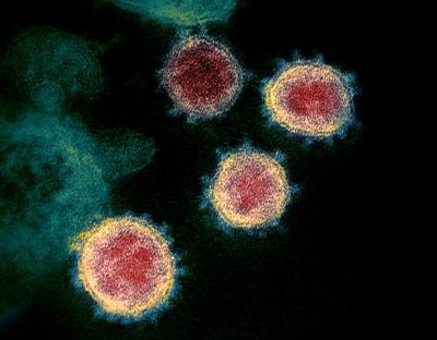 Protéines du SARS CoV-2, NIAID / CC BY (https://creativecommons.org/licenses/by/2.0) (https://commons.wikimedia.org/wiki/File:Novel_Coronavirus_SARS-CoV-2.jpg)