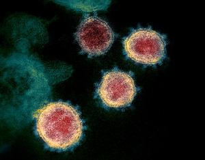 Protéines du SARS CoV-2, NIAID / CC BY (https://creativecommons.org/licenses/by/2.0) (https://commons.wikimedia.org/wiki/File:Novel_Coronavirus_SARS-CoV-2.jpg)